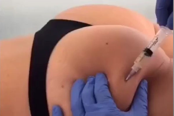 Plasma rico en plaquetas
